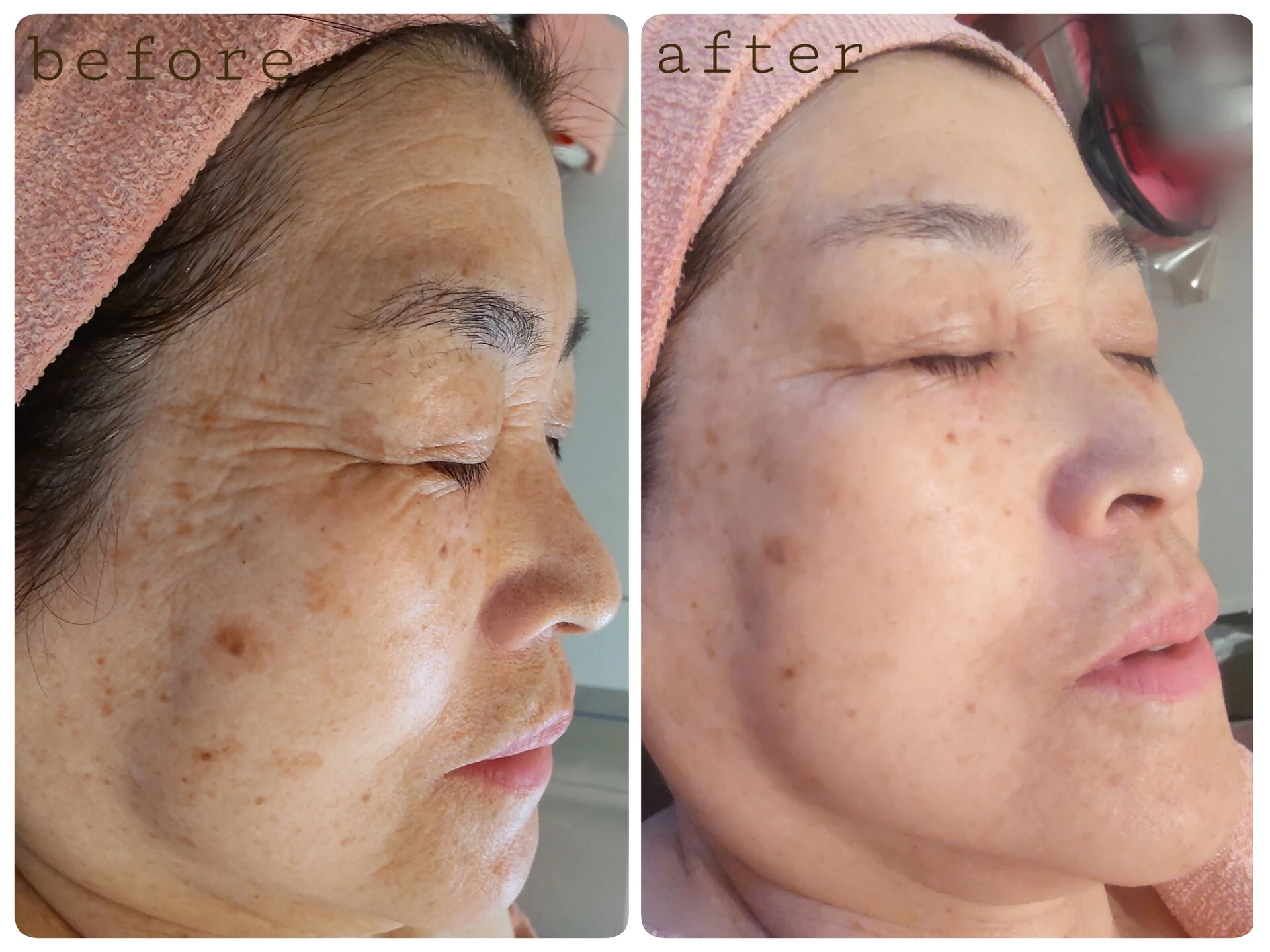 before・after　お写真